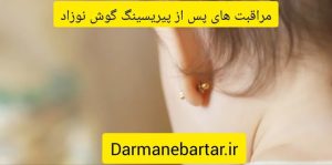مراقبت های پس از پیریسیگ گوش نوزاد
