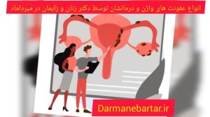 انواع عفونت های واژن و درمانشان توسط دکتر زنان و زایمان در میرداماد