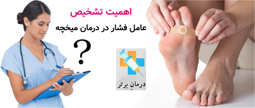 اهمیت تشخیص عامل فشار در درمان میخچه