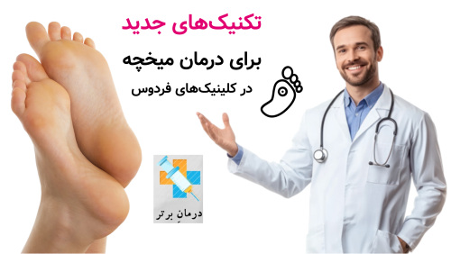 تکنیک‌های جدید برای درمان میخچه در کلینیک‌های فردوس