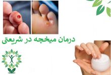 درمان-میحچه-شریعتی
