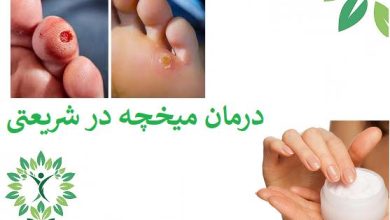 درمان-میحچه-شریعتی