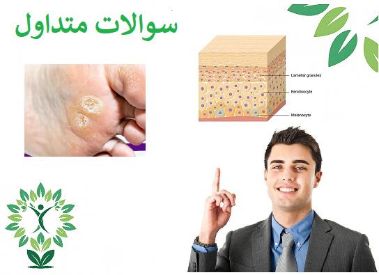 سؤالات متداول