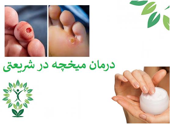 درمان-میحچه-شریعتی