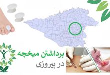 درمان میحچه پیروزی