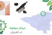 میخچه تجریش